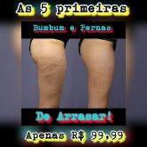 Pernas de ARRASAR