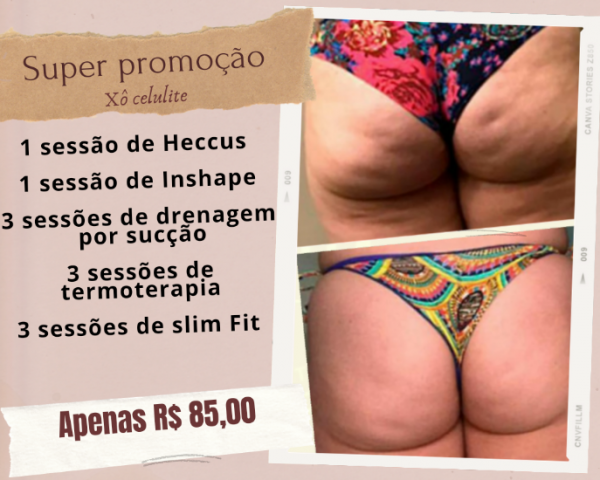 Super promoção xô celulite