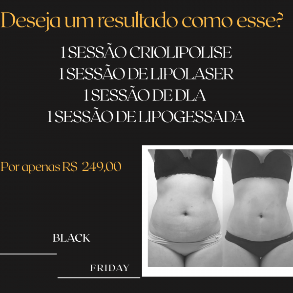 Super promoção Black Friday