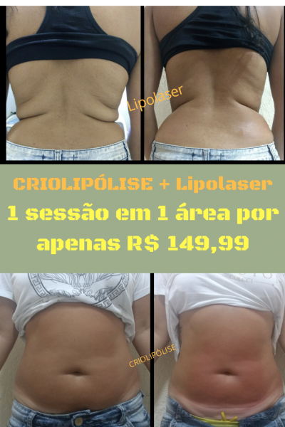 Loucura do Bibella ( super promoção)