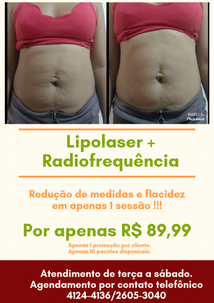 LIPOLASER + Radiofrequência