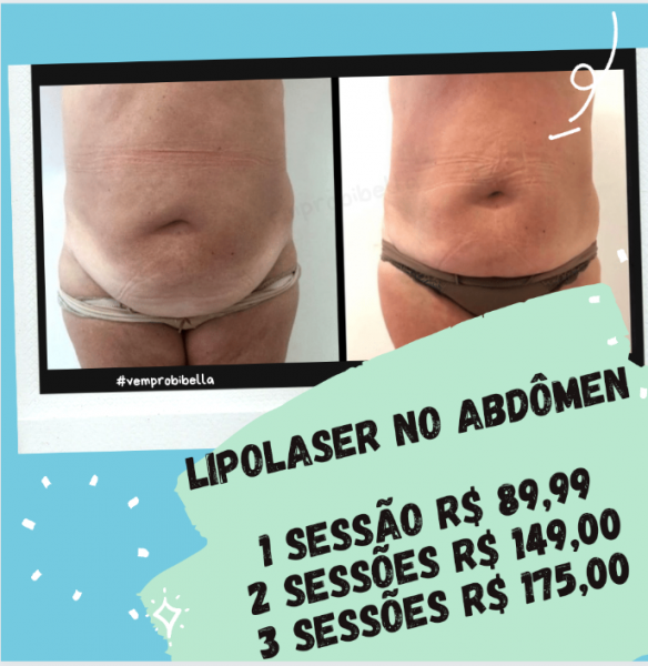 Lipolaser ( 2 sessões ou 2 áreas)