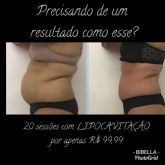 20 sessões com LIPOCAVITAÇÃO