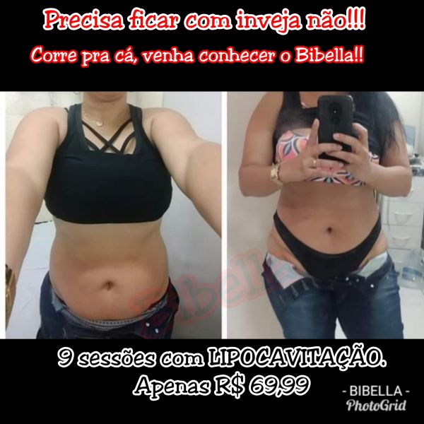 9 sessões com LIPOCAVITAÇÃO.