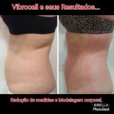 Vibrocell para redução de medidas e/ou celulite!