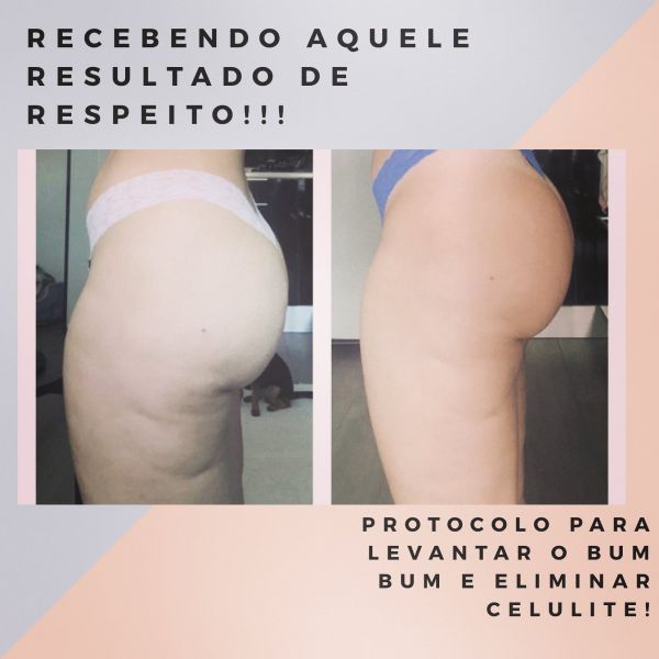 Intensivo para turbinar o popozão e detonar as celulites ( glúteo + posterior de coxa)