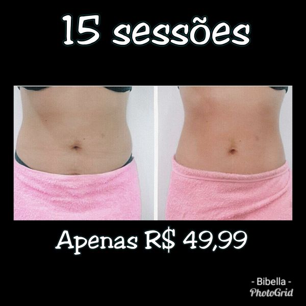 15 sessões com Lipocavitação+ lipogessada