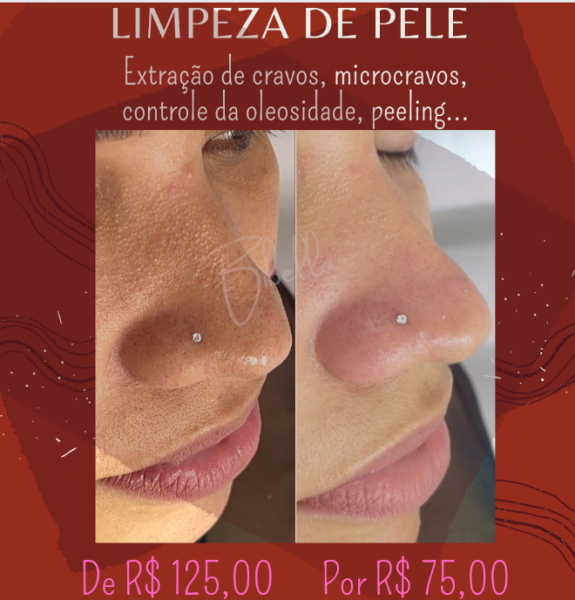 Limpeza de pele profunda