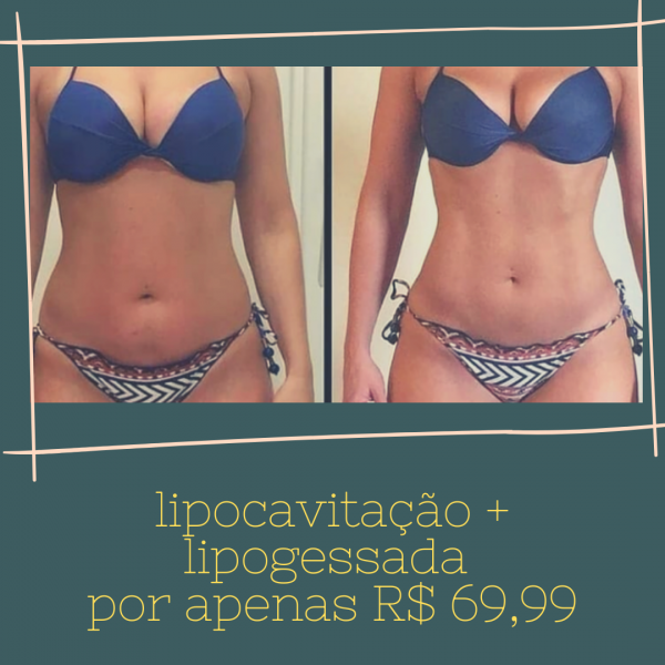 Lipocavitação + lipogessada