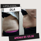 LIPOLASER + DLA