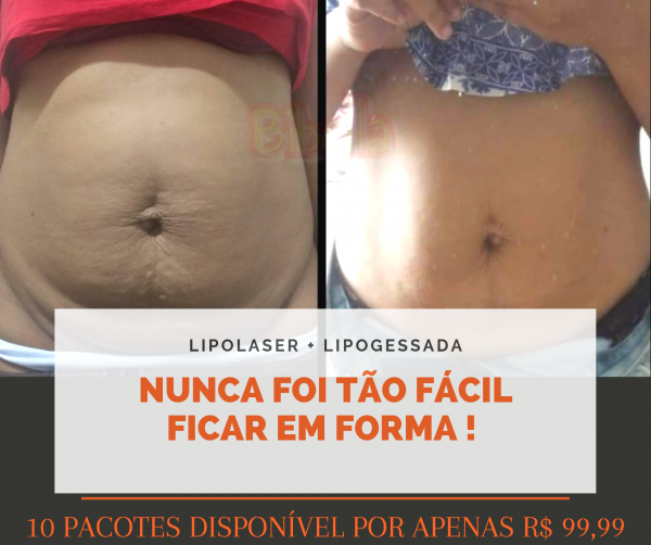 Casadinha Lipolaser + Lipogessada