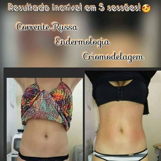 Cintura dos sonhos
