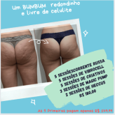 Bumbum livre de celulite, durinho e redondinho